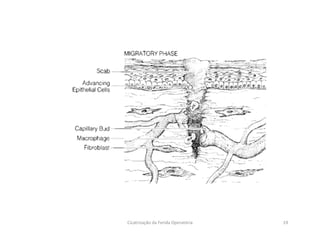 19Cicatrização da Ferida Operatória
 