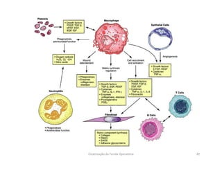 22Cicatrização da Ferida Operatória
 