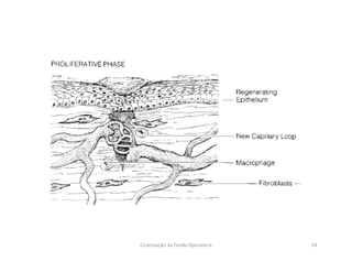 24Cicatrização da Ferida Operatória
 