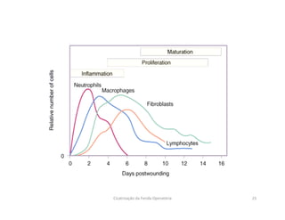 25Cicatrização da Ferida Operatória
 