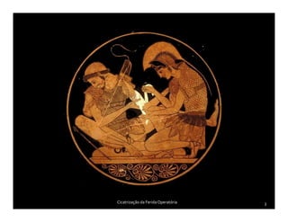 Cicatrização da FeridaOperatória 3
 