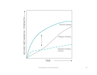 Cicatrização da Ferida Operatória 34
 