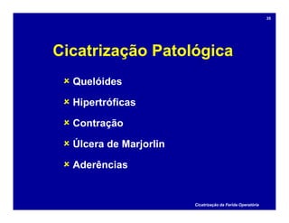 Cicatrização Patológica
 Quelóides
 Hipertróficas
 Contração
 Úlcera de Marjorlin
 Aderências
Cicatrização da Ferida Operatória
35
 