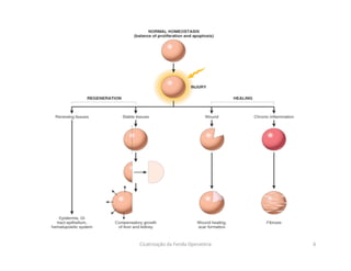 Cicatrização da Ferida Operatória 6
 