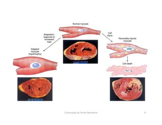 Cicatrização da Ferida Operatória 8
 