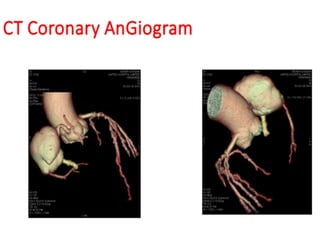 Comprehensive Overview of Coronary CT Angiography in CAD Diagnosis and ...