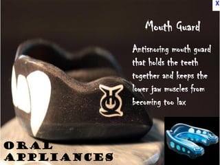Mouth Guard
             Antisnoring mouth guard
             that holds the teeth
             together and keeps the
             lower jaw muscles from
             becoming too lax



oral
appliances
 