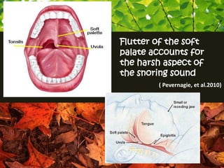 Flutter of the soft
palate accounts for
the harsh aspect of
the snoring sound
        ( Pevernagie, et al.2010)
 