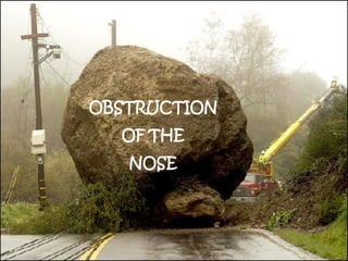 OBSTRUCTION
  OF THE
   NOSE
 