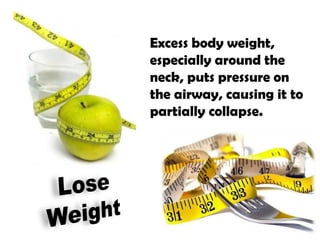 Excess body weight,
especially around the
neck, puts pressure on
the airway, causing it to
partially collapse.
 