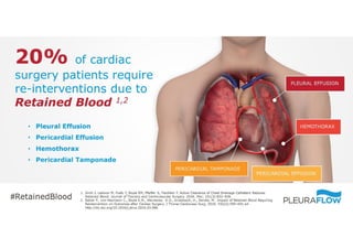 8. 20% of Cardiac Surgery Patients Require Re-Intervention Due To Retained Blood 