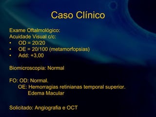 Caso Clínico
Exame Oftalmológico:
Acuidade Visual c/c:
• OD = 20/20
• OE = 20/100 (metamorfopsias)
• Add: +3,00
Biomicroscopia: Normal
FO: OD: Normal.
OE: Hemorragias retinianas temporal superior.
Edema Macular
Solicitado: Angiografia e OCT
 