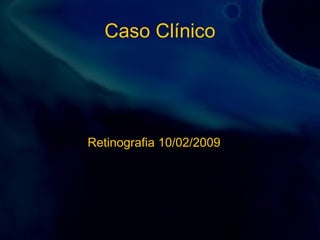 Caso Clínico
Retinografia 10/02/2009
 
