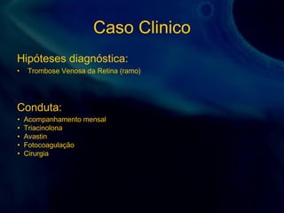 Caso Clinico
Hipóteses diagnóstica:
• Trombose Venosa da Retina (ramo)
Conduta:
• Acompanhamento mensal
• Triacinolona
• Avastin
• Fotocoagulação
• Cirurgia
 