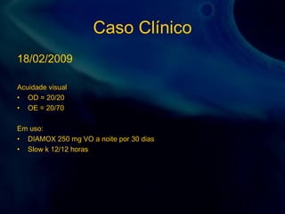 Caso Clínico
18/02/2009
Acuidade visual
• OD = 20/20
• OE = 20/70
Em uso:
• DIAMOX 250 mg VO a noite por 30 dias
• Slow k 12/12 horas
 