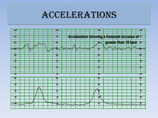 accelerations
 