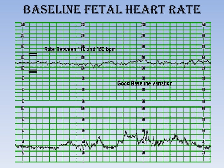 FETAL CARDIOTOCOGRAPHY DOWNLOAD FETAL CARDIOTOCOGRAPHY DOWNLOAD