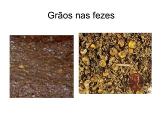 Grão inteiro de milho nas fezes indica que a
silagem não foi apropriadamente processada:
cortada muito grande, cortada muito
tardiamente, ou existe consumo ineficiente de
fibra fisicamente efetiva.
Grãos nas fezes
 