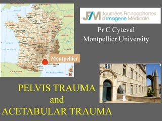 Pr C Cyteval
Montpellier University
Montpellier
PELVIS TRAUMA
and
ACETABULAR TRAUMA
 