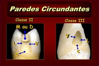  Ângulos Paredes São os limites internos das cavidades. 