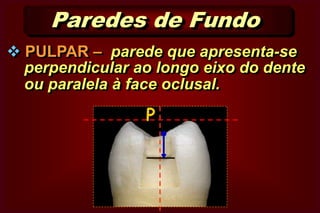  Fundo  Paredes Circundantes São as paredes laterais da cavidade. 
