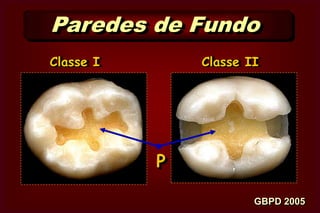  Recebem  o nome  da face do dente a que    correspondem   ou  estão  mais próximas.VDClasse IML