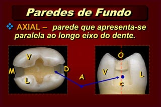Classe IIClasse IIIParedes CircundantesM ou DVLLVcc