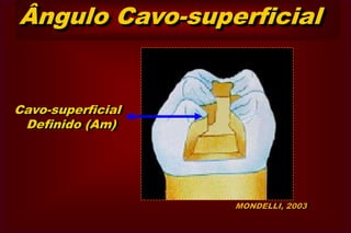 Ângulos Diedros      3o GrupoD ou MVVLP D     PAMACLÁxio Pulpar (A-P)              ouPulpo-Axial (P-A)
