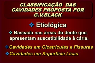 Ângulos TriedrosDisto-Linguo-Pulpar          D-L-PDVLACVestibulo-Cérvico-Axial (V-C-A)