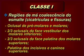 CLASSIFICAÇÃO  DAS CAVIDADES PROPOSTA POR  G.V.BLACK Etiológica 