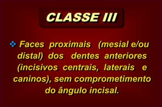 CICATRÍCULAS E FISSURASSucetibilidade à cárie