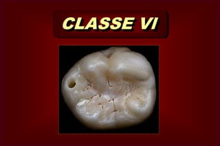 CICATRÍCULA E FISSURA