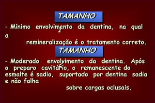 CLASSE I DE SOCKWELLCicatrículas e fissuras     incipientes “em ponto”  na face vestibular de    dentes anteriores.