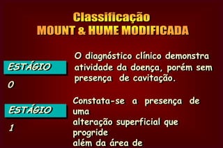 PRESERVATION AND RESTORATION             OF TOOTH STRUCTUREGraham J. Mount & W.R. Hume         Ed. Mosby, 1998     Nova Classificação  das Lesões  de  Cárie 
