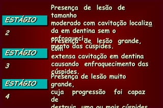 Considera os locais de maior acúmulo do biofilme, tanto na raíz como na coroa.CLASSIFICAÇÃO DE MOUNT & HUMETAMANHOE  NALOCALIZAÇÃODA  LESÃO  DE  CÁRIE Mount, G.J.; Hume, W.R., A revised classification of carious lesions by site and size. Quintessence  Int. 1997; 28; 301-303.