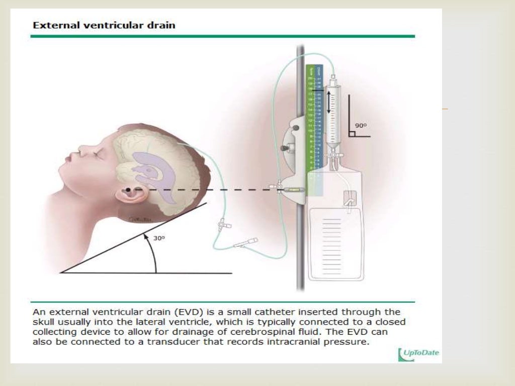 Increased intracranial pressure