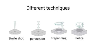 Different techniques
Single shot percussion trepanning helical
 