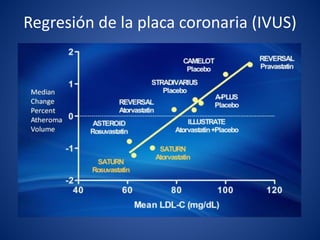 Regresión de la placa coronaria (IVUS)
 
