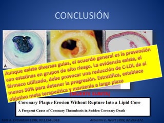 Farb A. Circulation 1996; 93:1354-1363. Arbustini E. Heart 1999; 82:269-272.
(MUERTE SUBITA)
CONCLUSIÓN
 