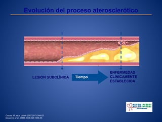 LESION SUBCLÍNICA
ENFERMEDAD
CLÍNICAMENTE
ESTABLECIDA
Tiempo
Evolución del proceso aterosclerótico
Crouse JR, et al. JAMA 2007;297:1344-53
Nissen S, et al. JAMA 2006;295:1556-65
 