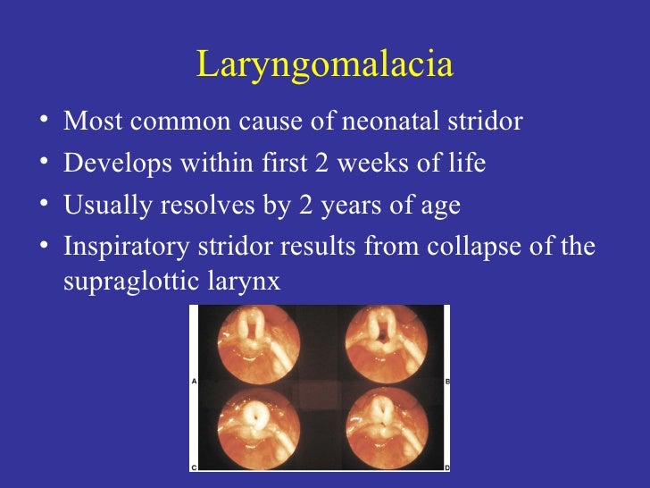 Cd6e Coclia86 Neonatal Resp Distress