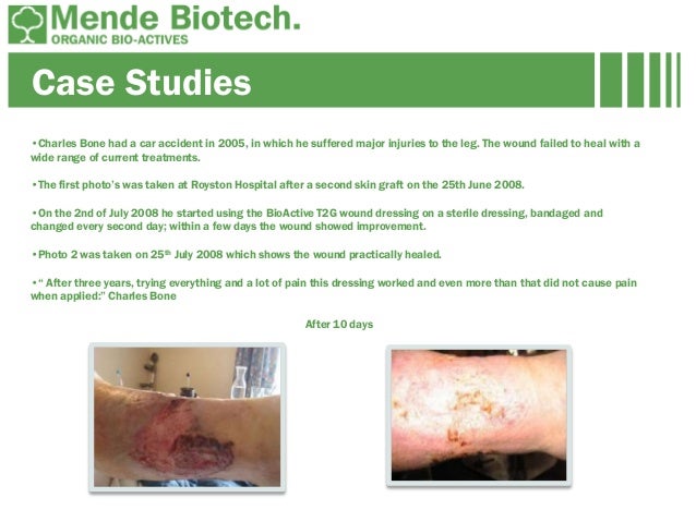 Collagen Wound Car Collagen Wound Car
