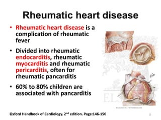 Rheumatic heart disease
• Rheumatic heart disease is a
complication of rheumatic
fever
• Divided into rheumatic
endocarditis, rheumatic
myocarditis and rheumatic
pericarditis, often for
rheumatic pancarditis
• 60% to 80% children are
associated with pancarditis
6/2/2015 11Oxford Handbook of Cardiology. 2nd edition. Page:146-150
 