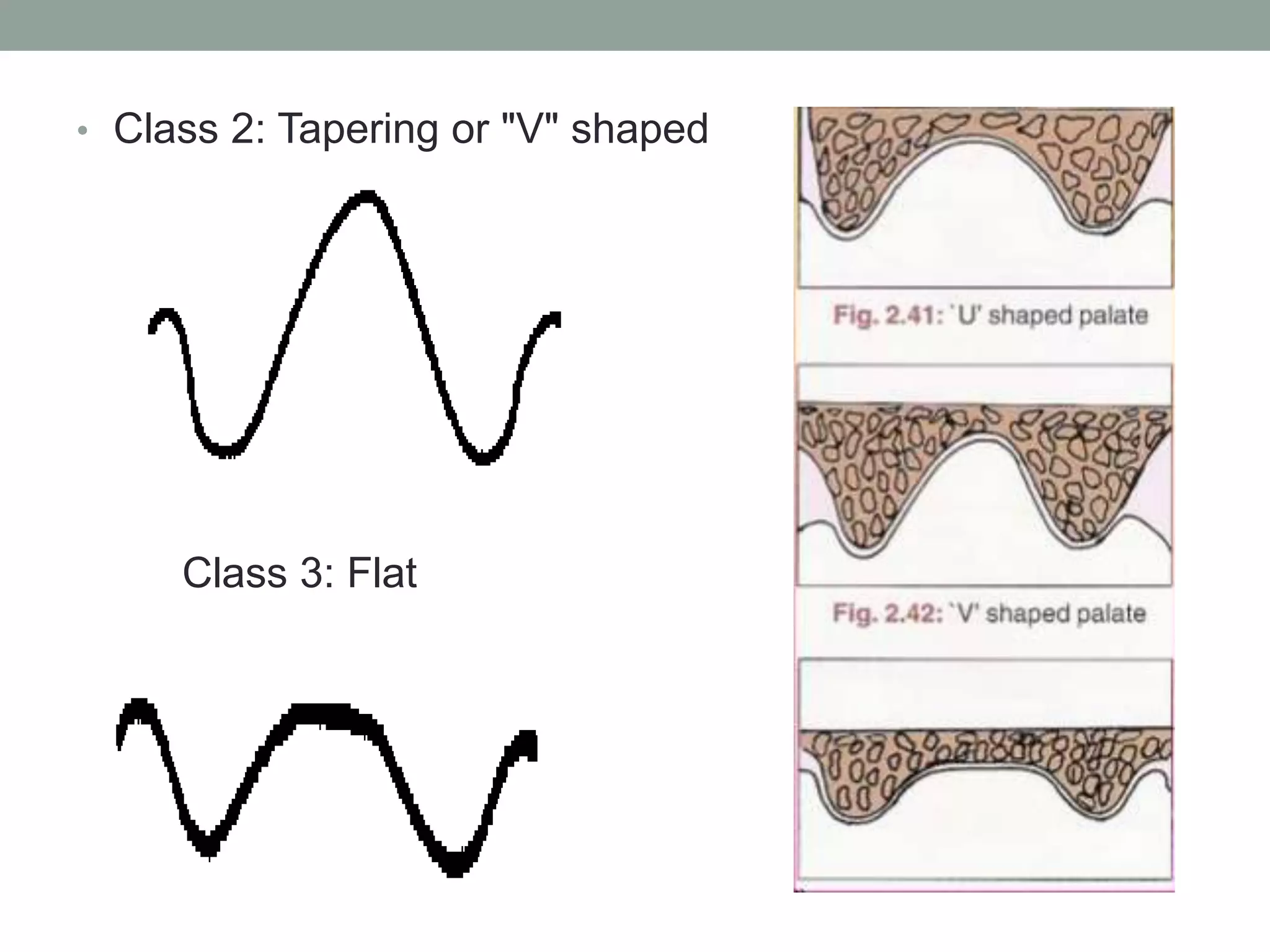 Complete denture case history | PPTX