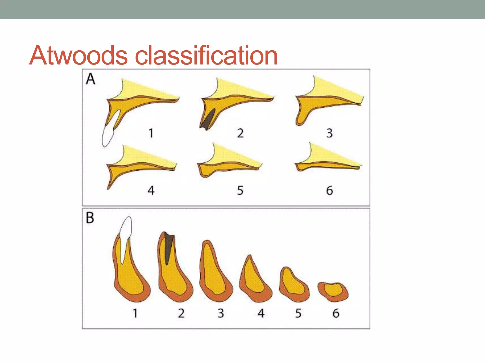 Complete denture case history | PPTX