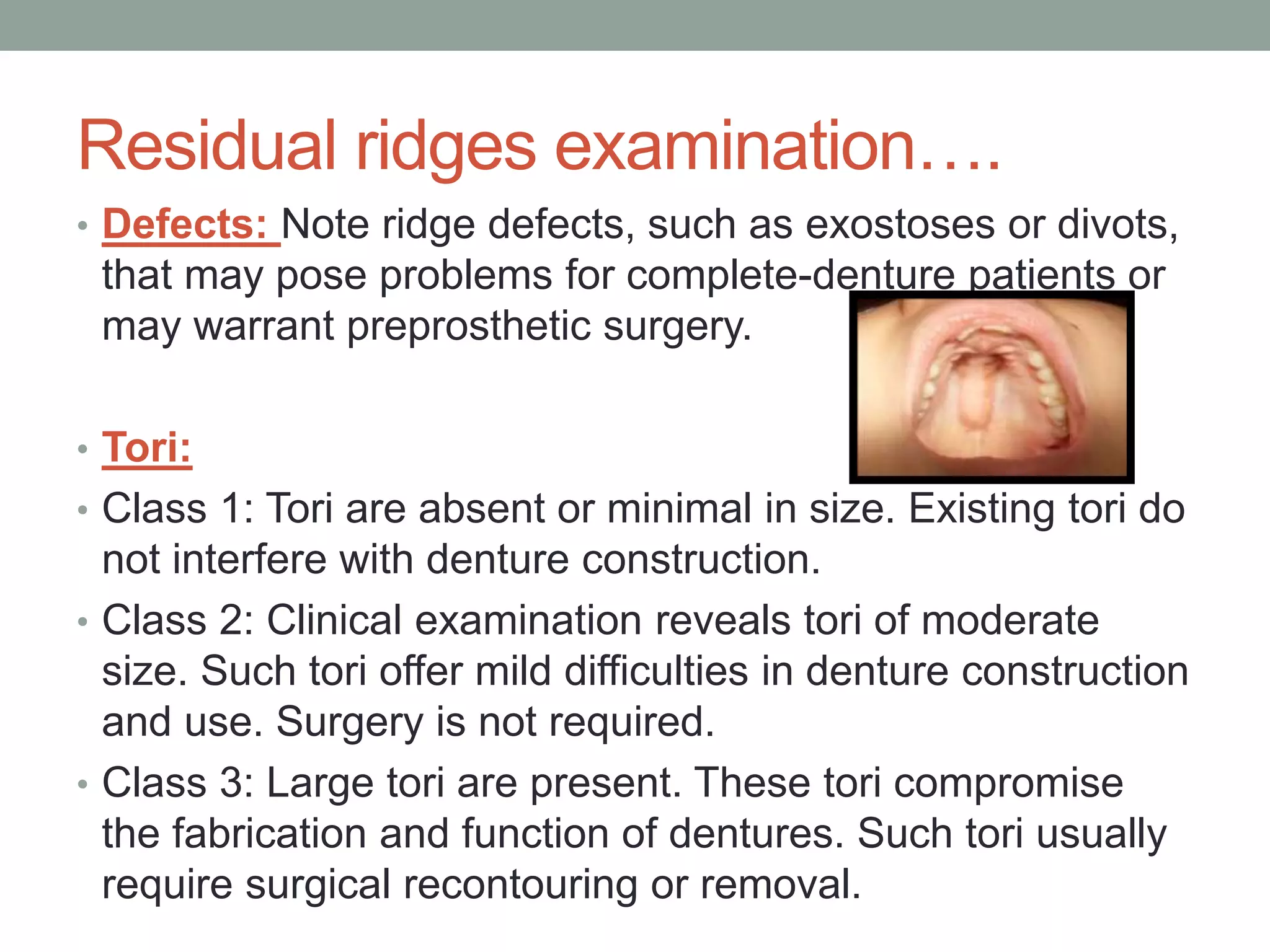 Complete denture case history | PPTX