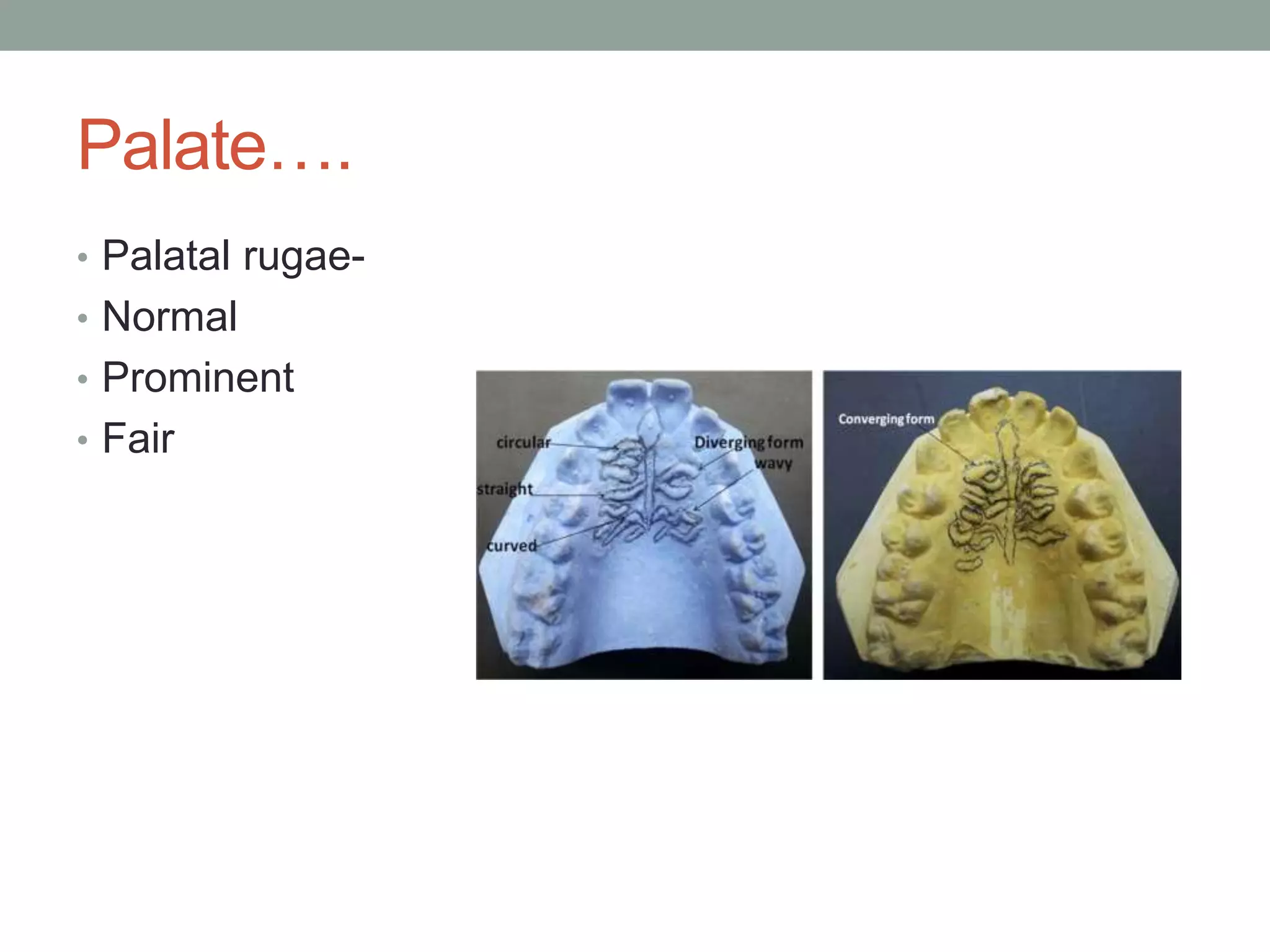 Complete denture case history | PPTX