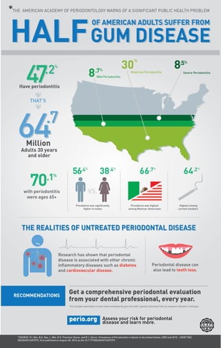 Prevalence of Periodontal Disease