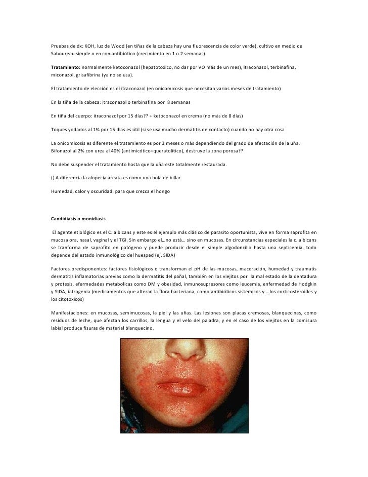 Los medios modernos eficaces del hongo de las uñas