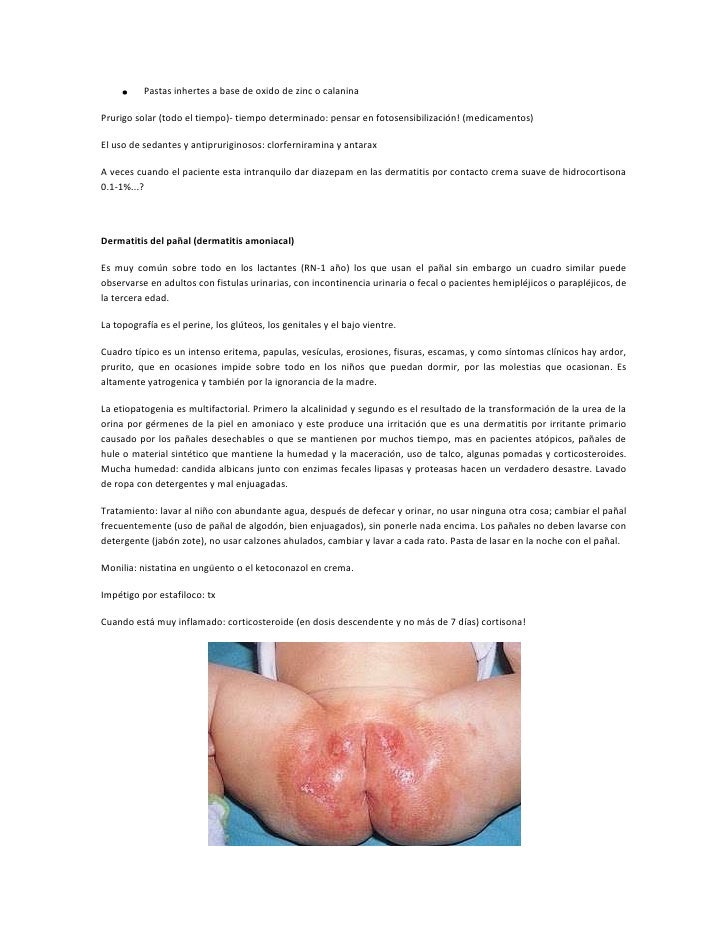 El azúcar para enfermo de la psoriasis